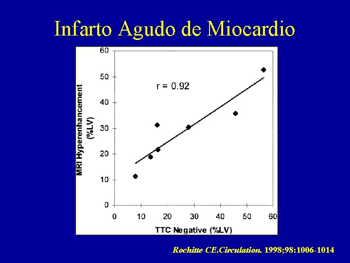 Infarto Agudo de Miocardio Rochitte CE. Circulation. 1998; 98: 1006 -1014 