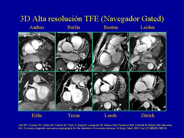 3 D Alta resolución TFE (Navegador Gated) Aarhus Berlin Boston Leiden Köln Texas Leeds