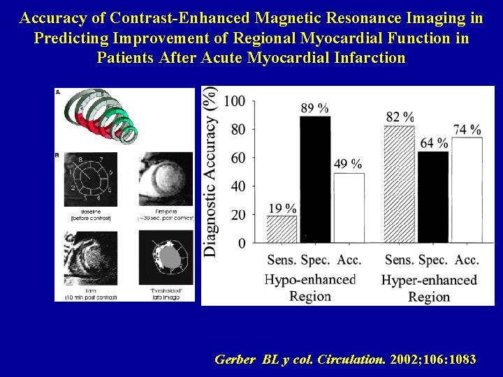 Accuracy of Contrast-Enhanced Magnetic Resonance Imaging in Predicting Improvement of Regional Myocardial Function in