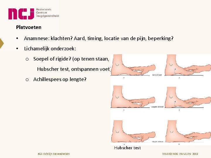 Platvoeten • Anamnese: klachten? Aard, timing, locatie van de pijn, beperking? • Lichamelijk onderzoek: