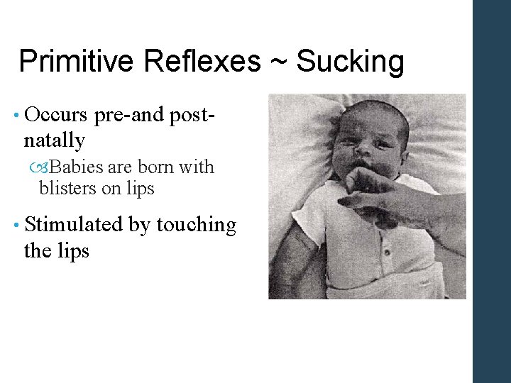 Primitive Reflexes ~ Sucking • Occurs pre-and post- natally Babies are born with blisters