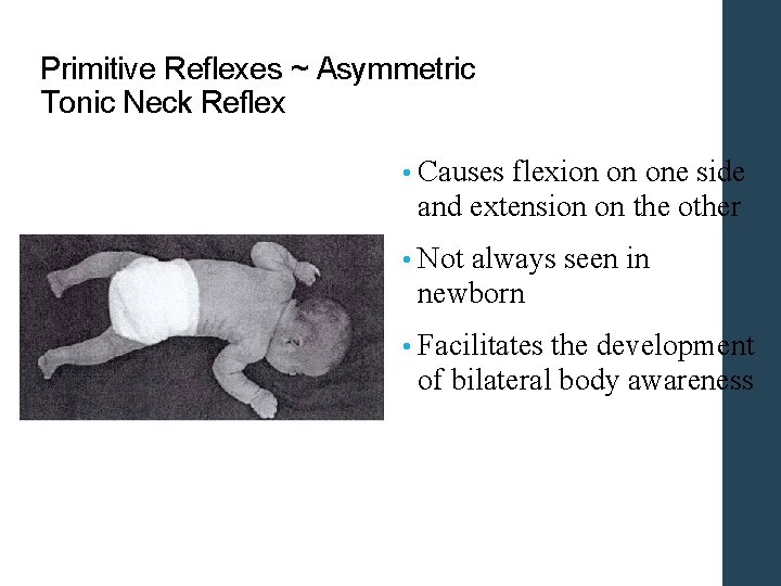 Primitive Reflexes ~ Asymmetric Tonic Neck Reflex • Causes flexion on one side and Primitive Reflexes ~ Asymmetric Tonic Neck Reflex • Causes flexion on one side and