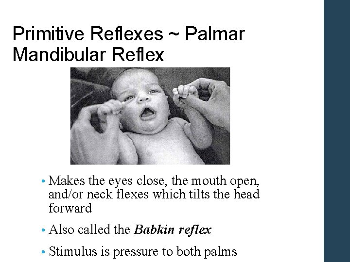 Primitive Reflexes ~ Palmar Mandibular Reflex • Makes the eyes close, the mouth open,