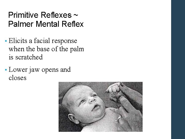 Primitive Reflexes ~ Palmer Mental Reflex • Elicits a facial response when the base