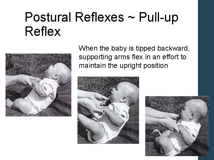 Postural Reflexes ~ Pull-up Reflex When the baby is tipped backward, supporting arms flex