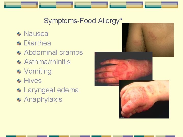 Symptoms-Food Allergy* Nausea Diarrhea Abdominal cramps Asthma/rhinitis Vomiting Hives Laryngeal edema Anaphylaxis 