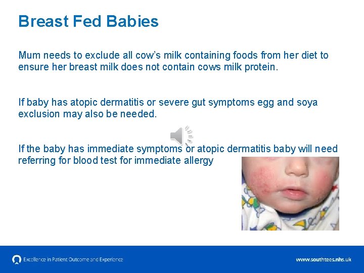 Breast Fed Babies Mum needs to exclude all cow’s milk containing foods from her
