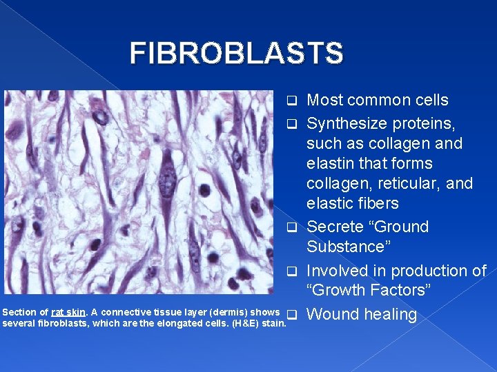 FIBROBLASTS q q Section of rat skin. A connective tissue layer (dermis) shows q