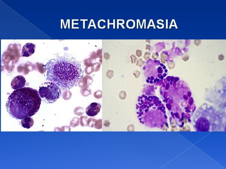 METACHROMASIA 