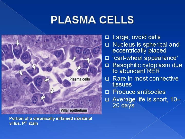 PLASMA CELLS q q q q Portion of a chronically inflamed intestinal villus. PT