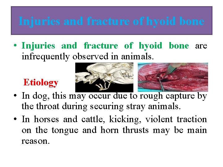 Injuries and fracture of hyoid bone • Injuries and fracture of hyoid bone are Injuries and fracture of hyoid bone • Injuries and fracture of hyoid bone are