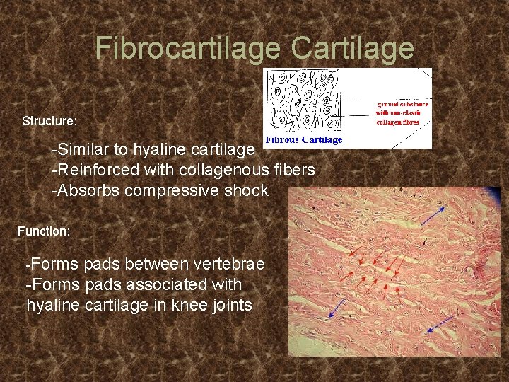 Fibrocartilage Cartilage Structure: -Similar to hyaline cartilage -Reinforced with collagenous fibers -Absorbs compressive shock