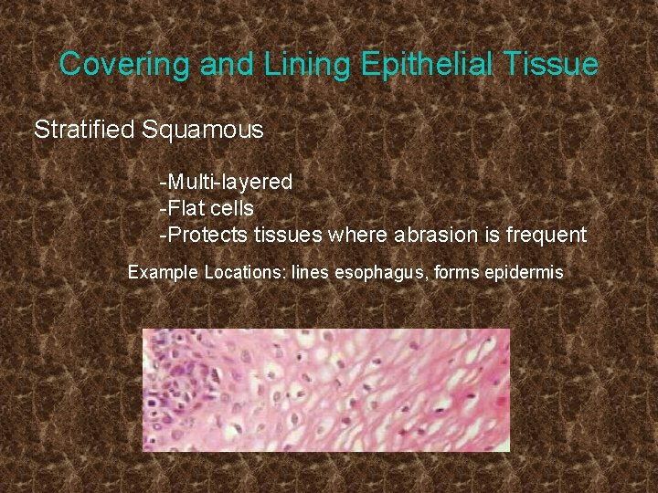 Covering and Lining Epithelial Tissue Stratified Squamous -Multi-layered -Flat cells -Protects tissues where abrasion