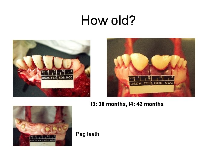 How old? I 3: 36 months, I 4: 42 months Peg teeth 