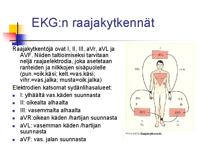 EKG: n raajakytkennät Raajakytkentöjä ovat I, III, a. Vr, a. VL ja AVF. Niiden EKG: n raajakytkennät Raajakytkentöjä ovat I, III, a. Vr, a. VL ja AVF. Niiden