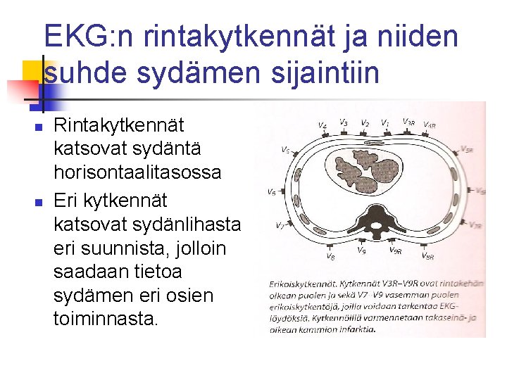 EKG: n rintakytkennät ja niiden suhde sydämen sijaintiin n n Rintakytkennät katsovat sydäntä horisontaalitasossa