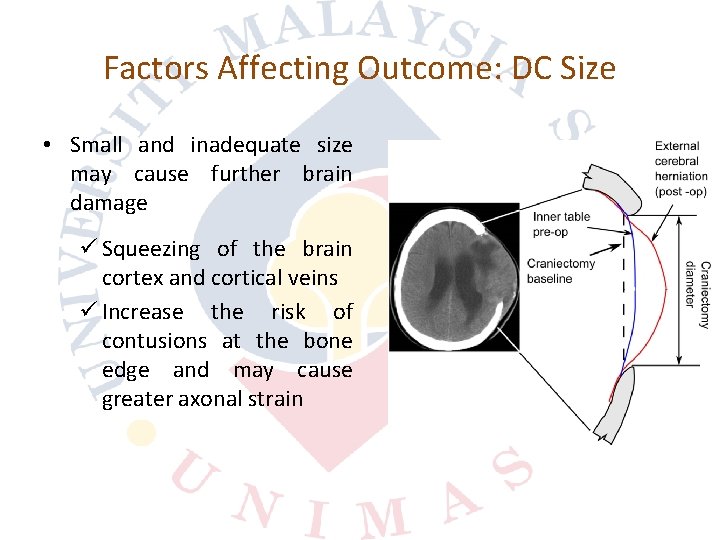 Factors Affecting Outcome: DC Size • Small and inadequate size may cause further brain
