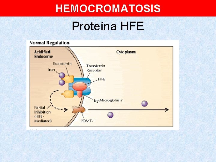 HEMOCROMATOSIS Proteína HFE 