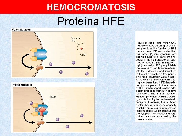 HEMOCROMATOSIS Proteína HFE 