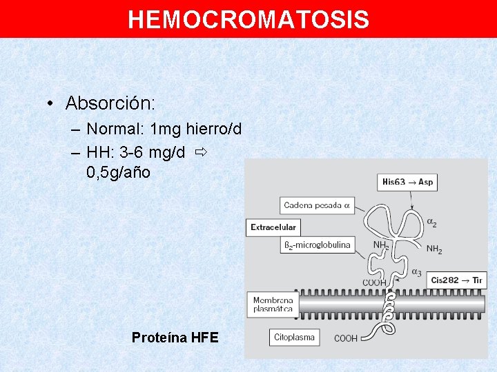 HEMOCROMATOSIS • Absorción: – Normal: 1 mg hierro/d – HH: 3 -6 mg/d 0,