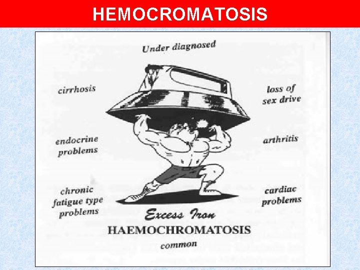 HEMOCROMATOSIS 