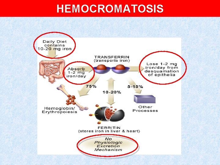 HEMOCROMATOSIS 