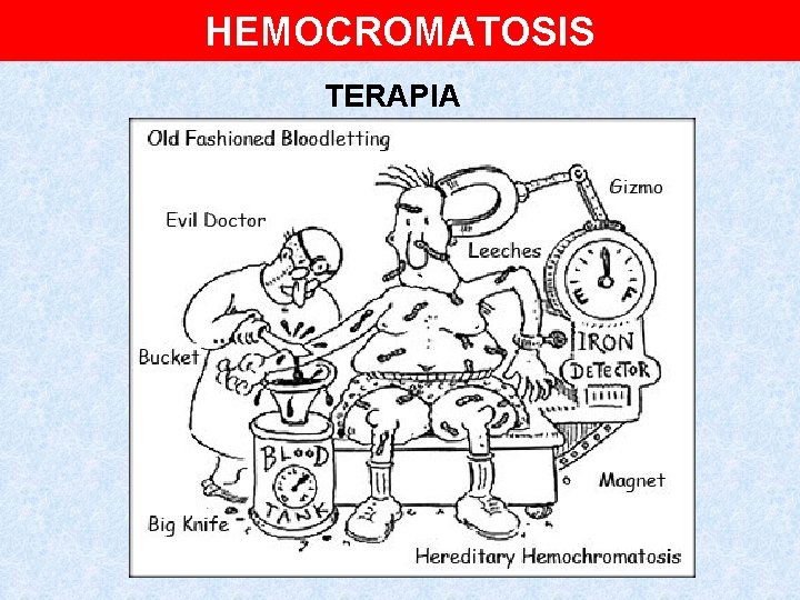 HEMOCROMATOSIS TERAPIA 