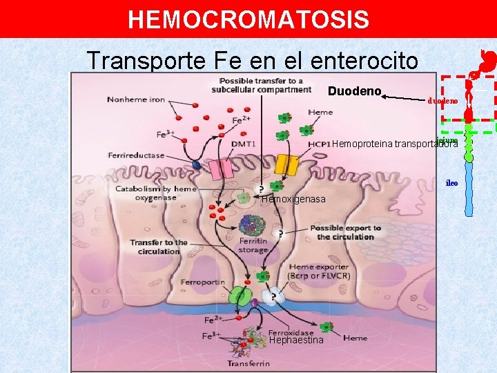 HEMOCROMATOSIS Transporte Fe en el enterocito Duodeno duodeno jejuno Hemoproteina transportadora íleo Hemoxigenasa Hephaestina