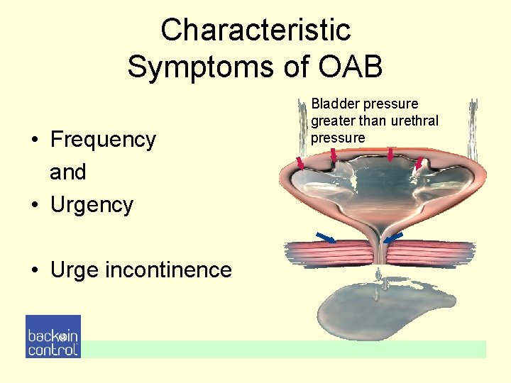 Characteristic Symptoms of OAB • Frequency and • Urgency • Urge incontinence Bladder pressure Characteristic Symptoms of OAB • Frequency and • Urgency • Urge incontinence Bladder pressure
