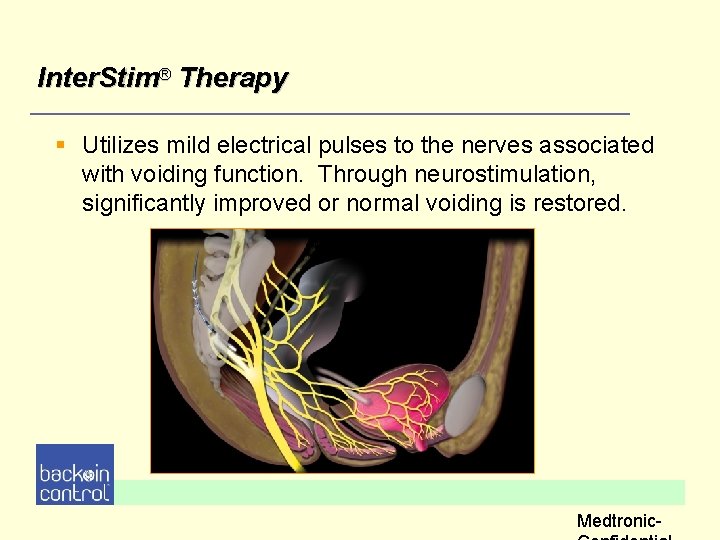 Inter. Stim® Therapy § Utilizes mild electrical pulses to the nerves associated with voiding Inter. Stim® Therapy § Utilizes mild electrical pulses to the nerves associated with voiding
