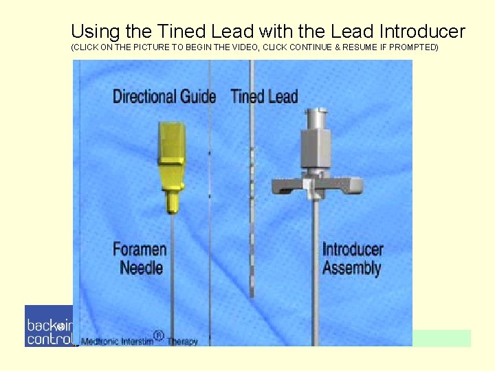 Using the Tined Lead with the Lead Introducer (CLICK ON THE PICTURE TO BEGIN Using the Tined Lead with the Lead Introducer (CLICK ON THE PICTURE TO BEGIN
