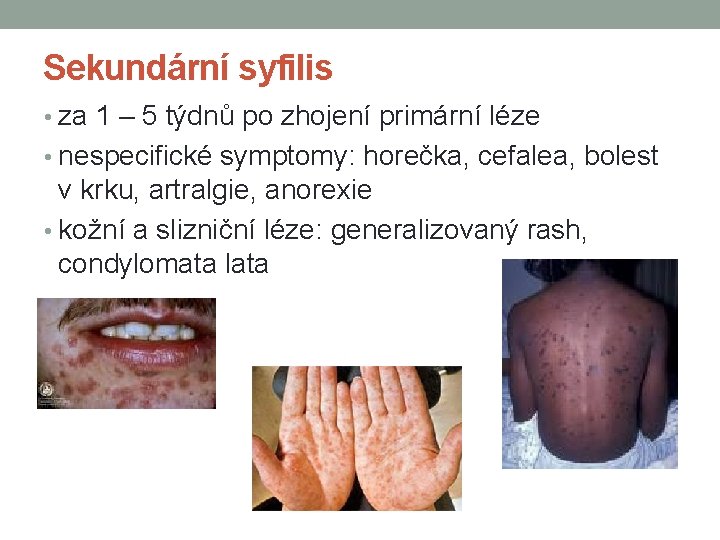 Sekundární syfilis • za 1 – 5 týdnů po zhojení primární léze • nespecifické