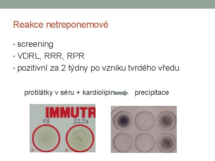 Reakce netreponemové • screening • VDRL, RRR, RPR • pozitivní za 2 týdny po