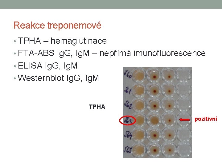 Reakce treponemové • TPHA – hemaglutinace • FTA-ABS Ig. G, Ig. M – nepřímá