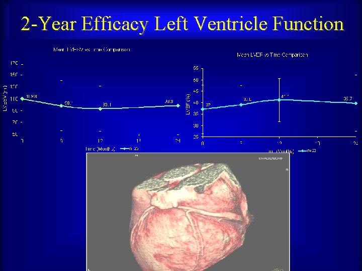 2 -Year Efficacy Left Ventricle Function Maurice Buchbinder, MD Foundation for Cardiovascular Medicine 