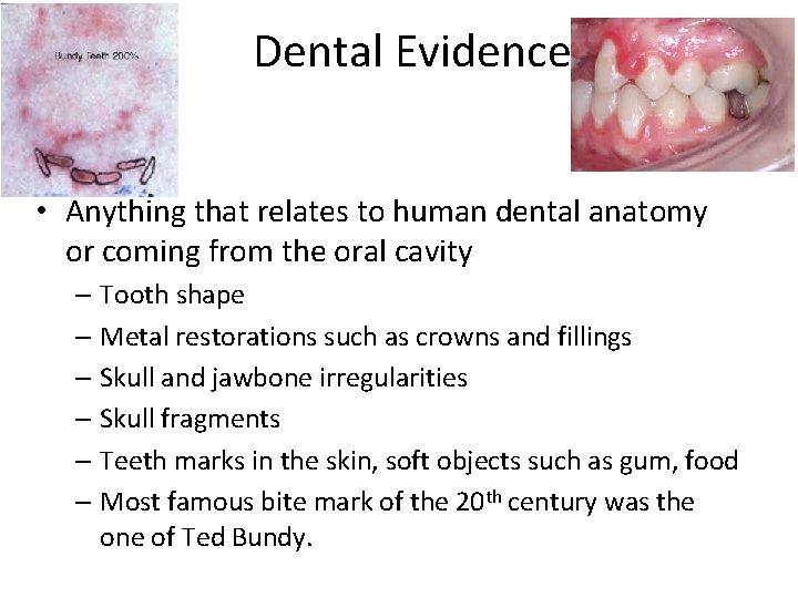 Dental Evidence • Anything that relates to human dental anatomy or coming from the