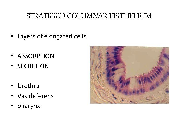 STRATIFIED COLUMNAR EPITHELIUM • Layers of elongated cells • ABSORPTION • SECRETION • Urethra