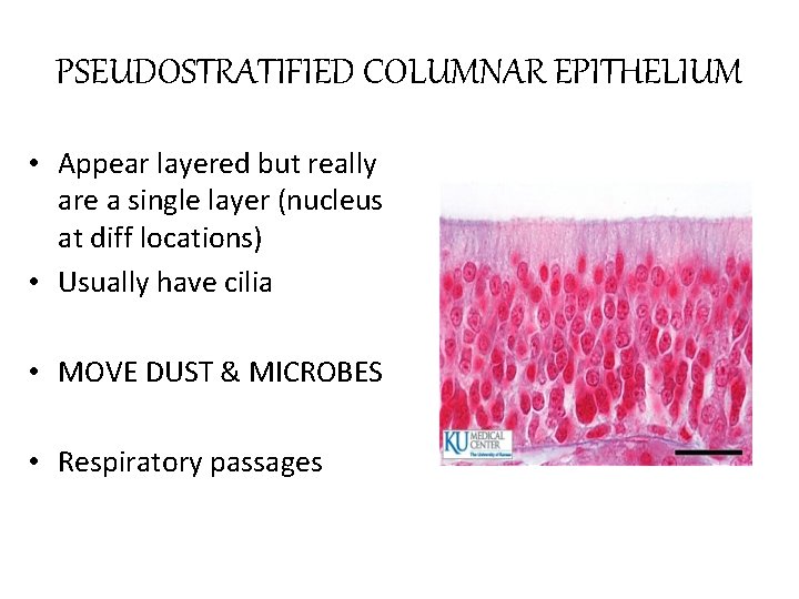 PSEUDOSTRATIFIED COLUMNAR EPITHELIUM • Appear layered but really are a single layer (nucleus at