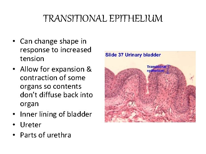 TRANSITIONAL EPITHELIUM • Can change shape in response to increased tension • Allow for