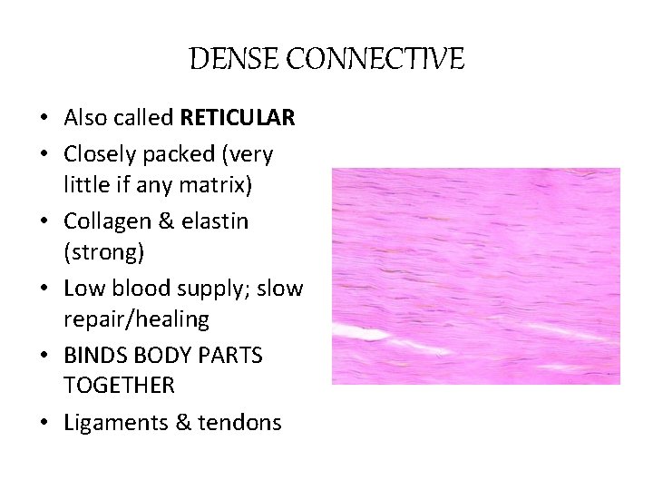 DENSE CONNECTIVE • Also called RETICULAR • Closely packed (very little if any matrix)