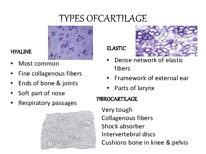 TYPES OFCARTILAGE HYALINE • • • Most common Fine collagenous fibers Ends of bone