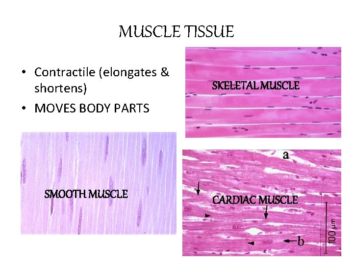 MUSCLE TISSUE • Contractile (elongates & shortens) • MOVES BODY PARTS SMOOTH MUSCLE SKELETAL