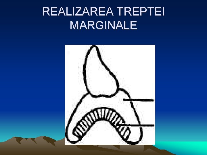 REALIZAREA TREPTEI MARGINALE 