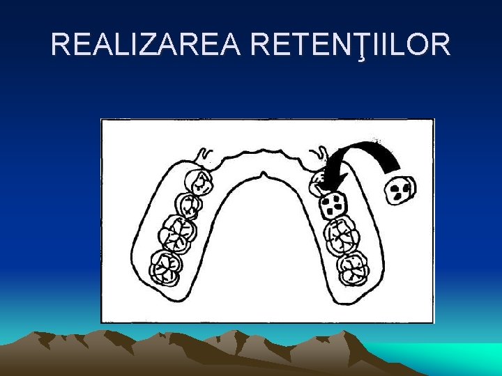 REALIZAREA RETENŢIILOR 