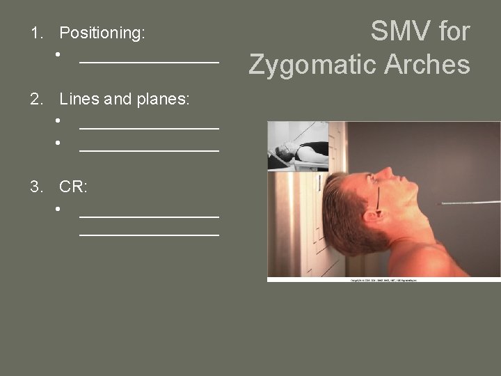1. Positioning: • ________ 2. Lines and planes: • _______________ 3. CR: • _______________
