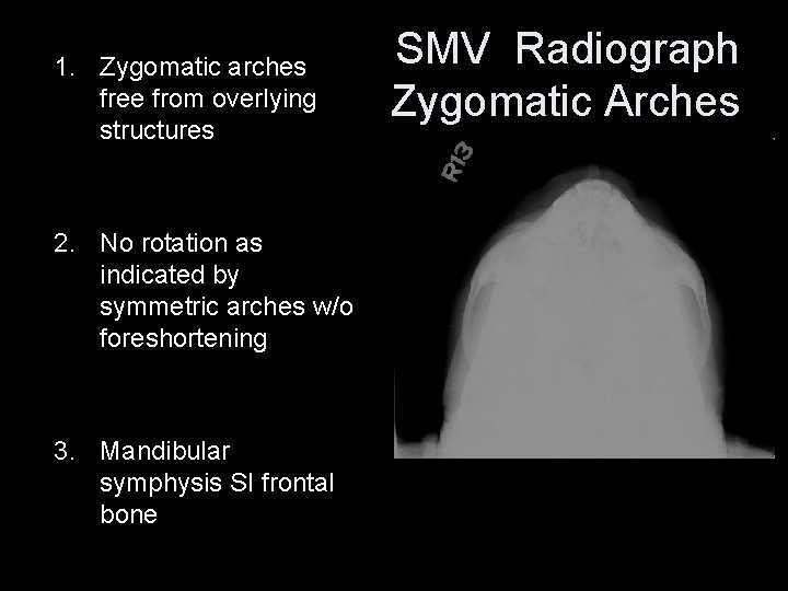 1. Zygomatic arches free from overlying structures 2. No rotation as indicated by symmetric