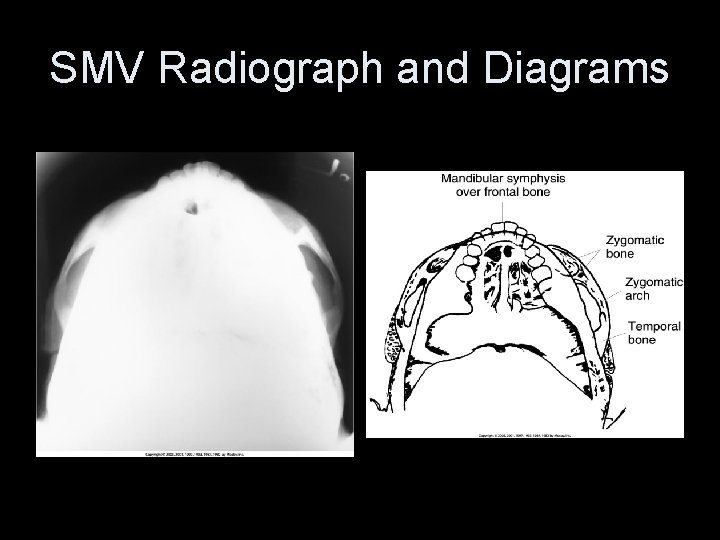 SMV Radiograph and Diagrams 