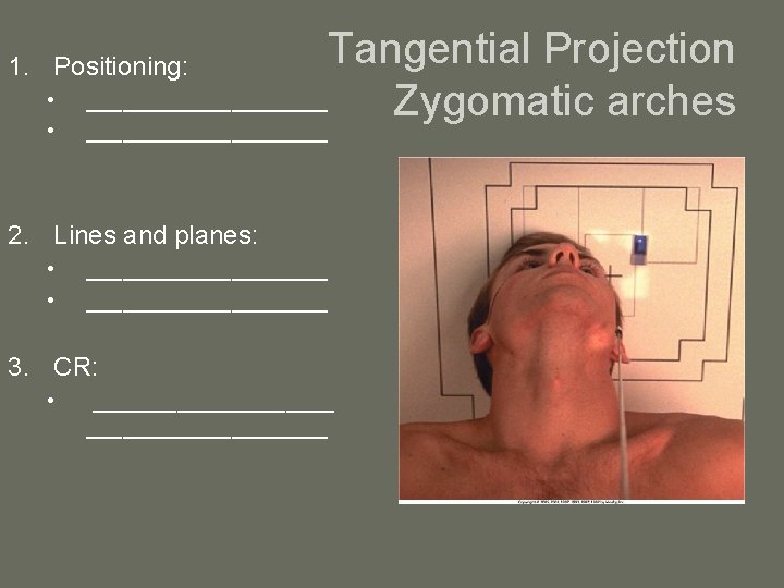 Tangential Projection __________ Zygomatic arches 1. Positioning: • • __________ 2. Lines and planes:
