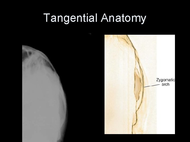 Tangential Anatomy 