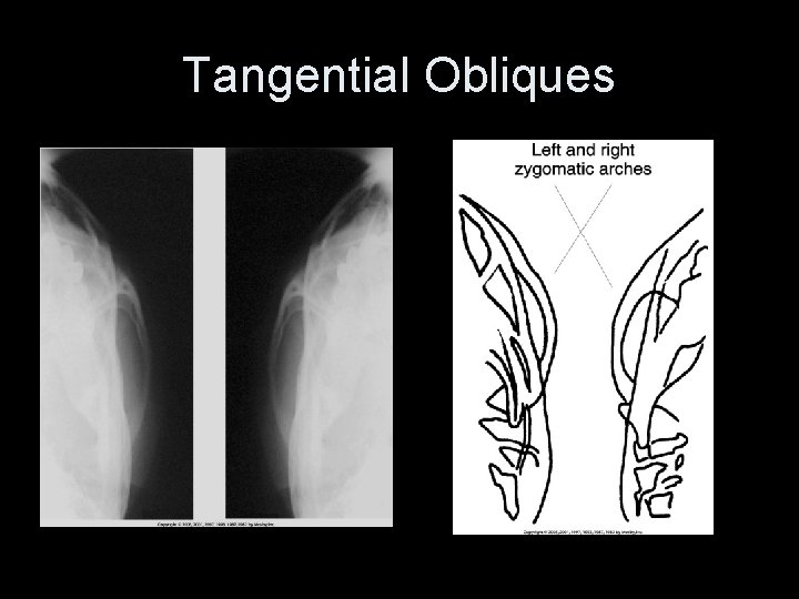 Tangential Obliques 